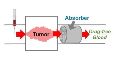 3D-printed sponge could reduce side effects of chemotherapy 