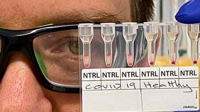 Covid-19 antibody test gives results in 20 minutes